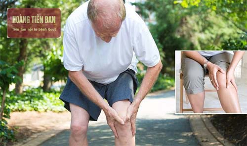 Thoái hóa khớp gối gây đau nhức cho người bệnh