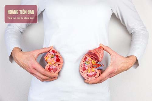 Suy thận giai đoạn cuối thường gây ra những biến chứng nguy hiểm.