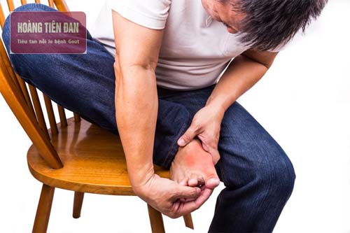 Gout thường gây đau đớn cho người bệnh.
