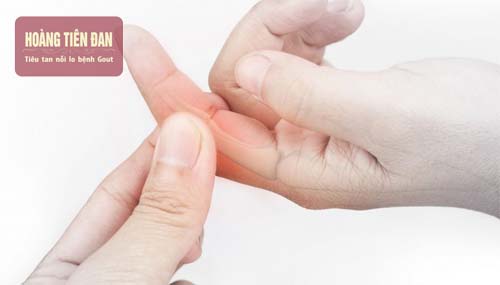 Sưng đỏ khớp ngón tay gây đau đớn và khó chịu