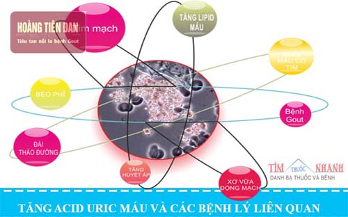 Những bệnh lý liên quan khi cơ thể tăng acid uric máu.