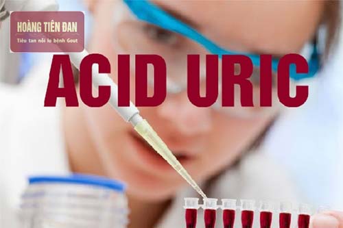 Xét nghiệm điển biết nồng độ acid uric trong máu