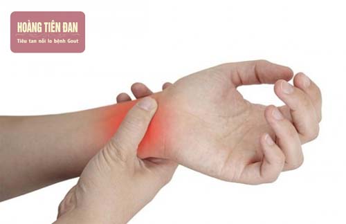 Tràn dịch khớp cổ tay gây sưng nề và đau đớn