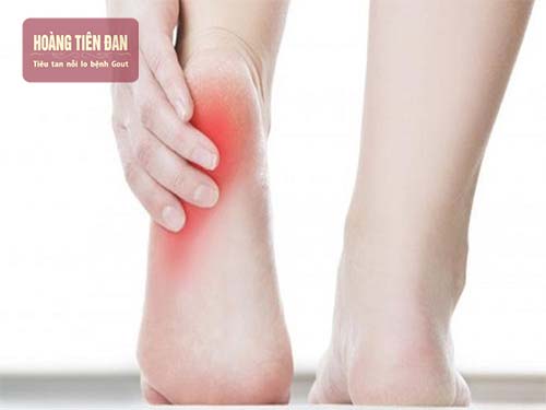 Có rất nhiều nguyên nhân dẫn đến bệnh gout