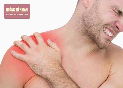 Thoái hóa khớp vai cần được phát hiện và điều trị kịp thời nhằm tránh các biến chứng