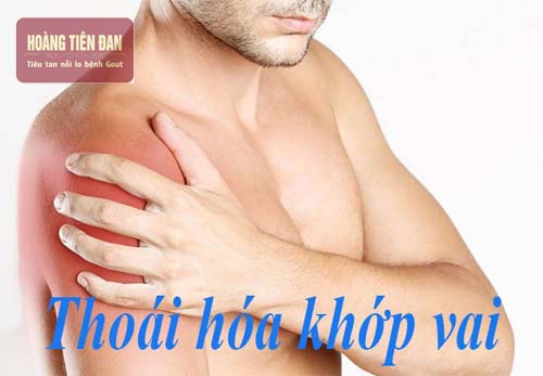 Thoái hóa khớp vai gây cảm giác đau nhức, khó chịu