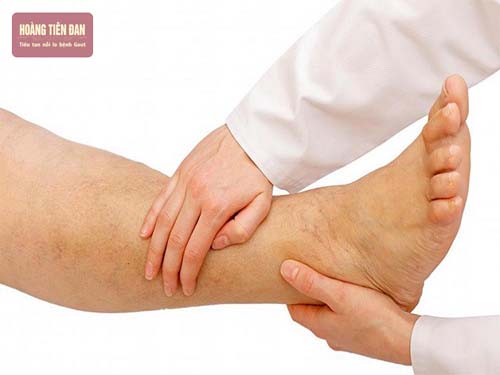 Có nhiều biện pháp để soi dịch khớp cổ chân.