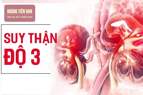  Điều trị suy thận độ 3 kịp thời để ngăn ngừa tiến triển của bệnh.