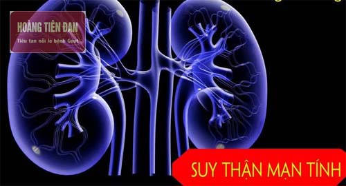 Suy thận mạn tính.