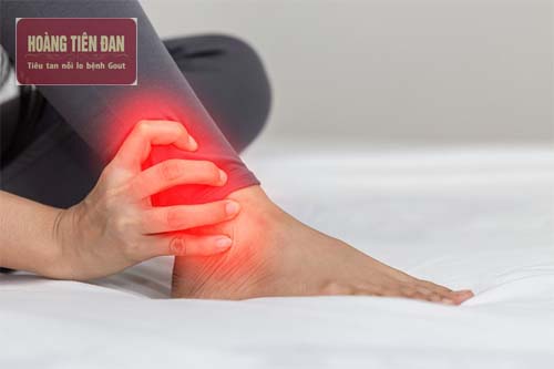  Đau nhức khớp cổ chân khiến di chuyển khó khăn.