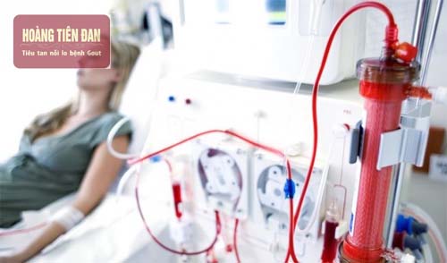 Lọc máu giúp duy trì sự sống cho người bị suy thận độ 5.