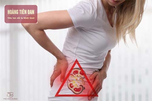  Người bị suy thận độ 1 thường bị đau hai bên hố lưng gần thận