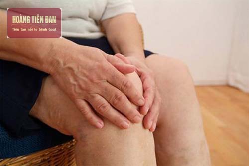   Thoái hóa khớp gối thường gặp ở người lớn tuổi.