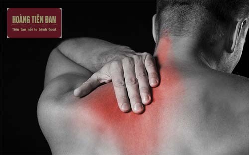 Cơ đau do gout thường xuất hiện về đêm.