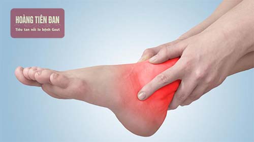 Viêm khớp mắt cá chân gây đau nhức, khó khăn khi vận động