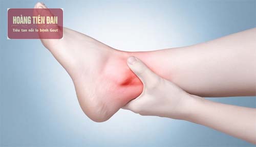  Có nhiều nguyên nhân gây tràn dịch khớp cổ chân.