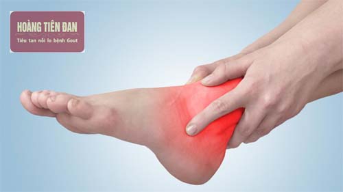 Viêm khớp cổ chân gây đau nhức khi vận động.