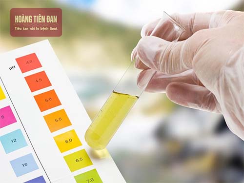 Xét nghiệm acid uric sẽ giúp phát hiện ra một số loại bệnh