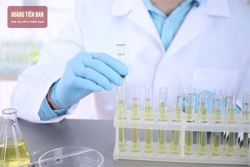 Quy trình xét nghiệm acid uric trong nước tiểu