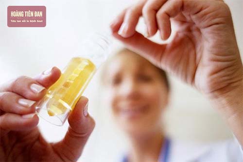 Acid uric trong có vai trò rất quan trọng trong cơ thể