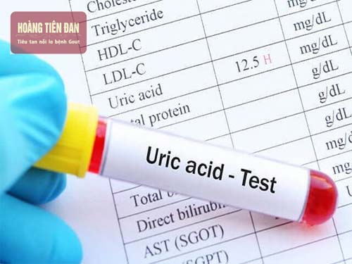 Nồng độ acid uric trong máu phản ánh được sức khỏe của con người