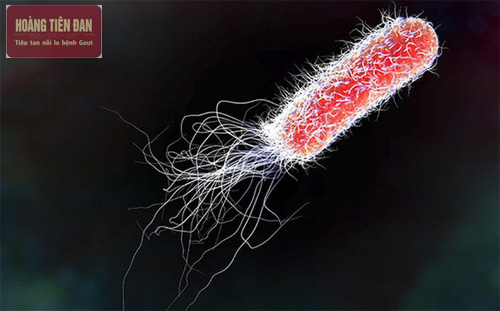 Vi khuẩn E Coli là một trong số vi khuẩn gây viêm đài bể thận