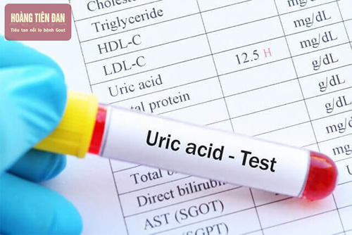 Acid uric được tạo ra do nhiều nguyên nhân
