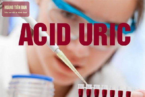 Chỉ số acid uric bình thường là dưới 7,0 mg/dl (420 micromol/l)